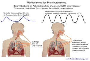 Mechanismus des Branchospasmus