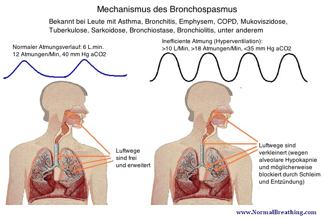 Zusammenhang Atmung und Bronchospasmus