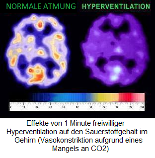 Sauerstoffi im gehirn