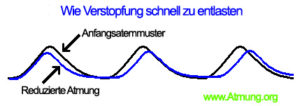 Wie Verstopfung schnell zu entlasten